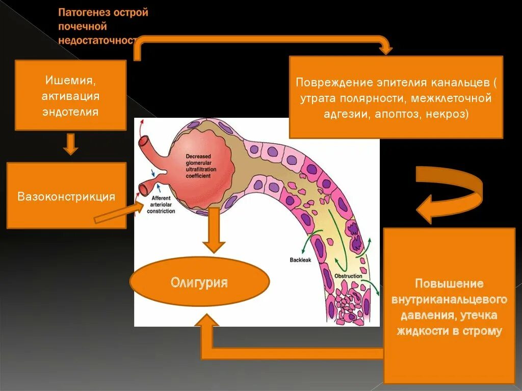 Острое почечное повреждение патанатомия. Острое почечное повреждение патогенез. Острое повреждение почек этиология. Механизм развития почечной недостаточности. Патогенез почки