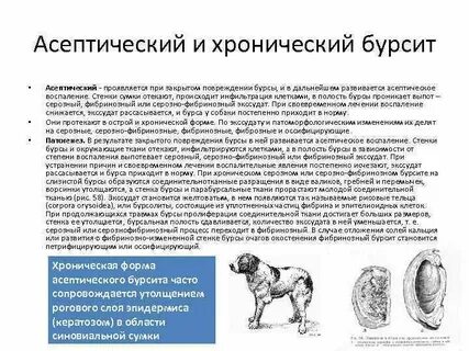 Асептическое воспаление