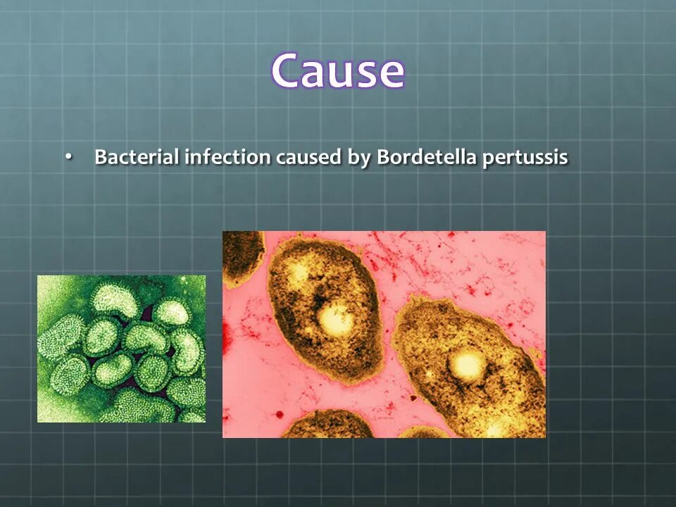 Causing infection