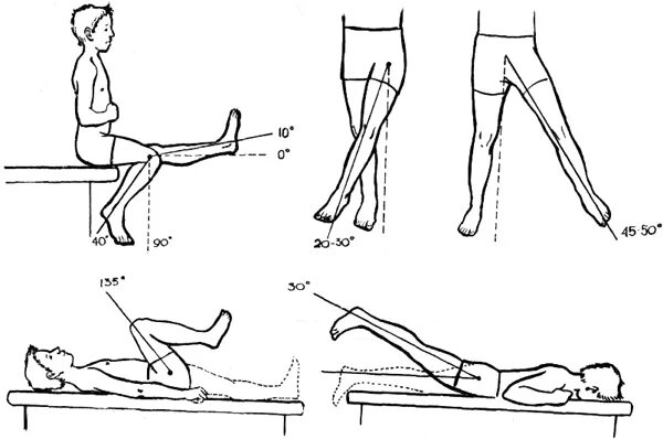 Гониометрия тазобедренного сустава. Сгибательная контрактура локтевого сустава. Контрактура коленного сустава ЛФК. Разгибание тазобедренного сустава гониометрия. Тесты на коленный сустав