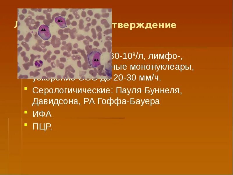 Атипичных мононуклеаров