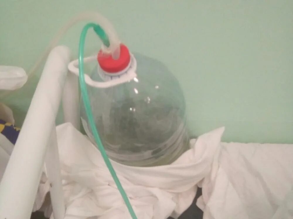 Why does a gastroscopy have to be performed under general anesthesia?. Трубка в больнице. Трубка в больнице. Фгс аппарат. Трубка в больнице.