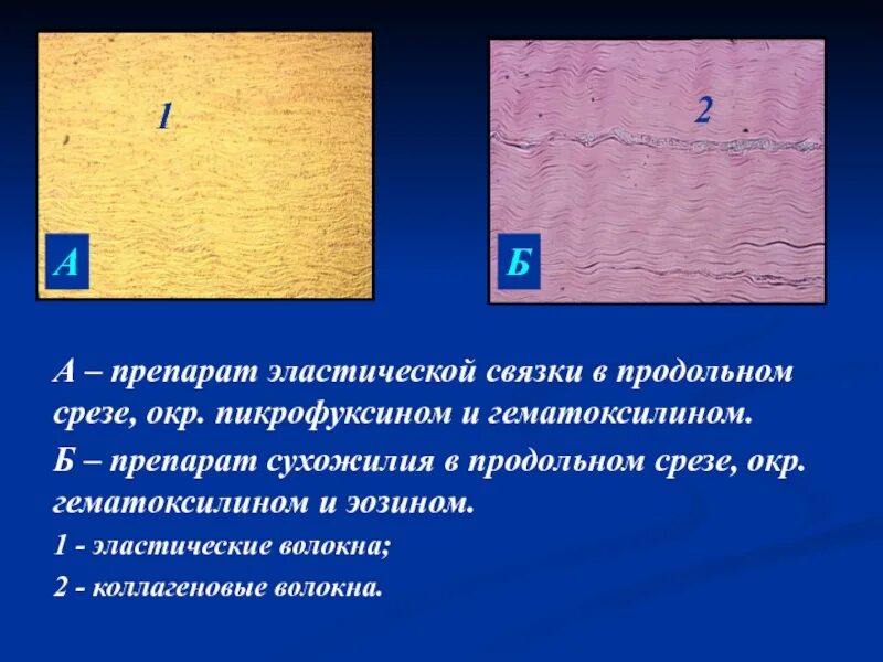 Эластическая связка. Плотная оформленная волокнистая соединительная ткань связка. плотная оформленная эластическая соединительная ткань. эластическая соединительная ткань связка. эластическая оформленная волокнистая соединительная ткань.