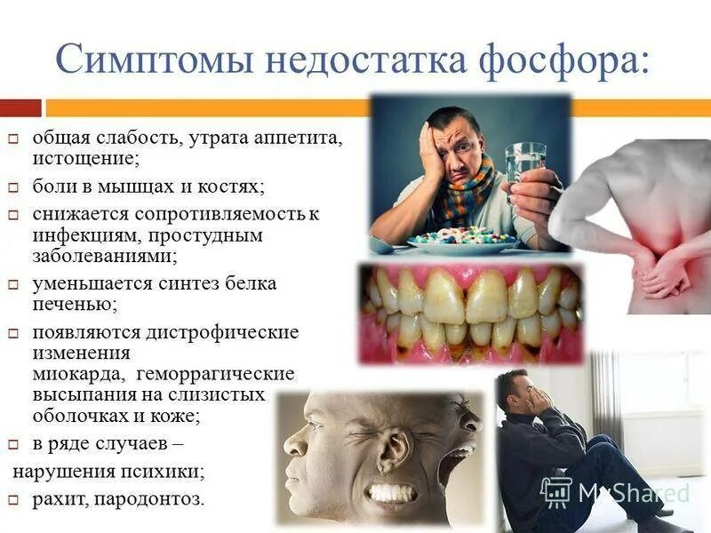 Недостаток фтора может привести к развитию. Дефицит фосфора в организме человека. симптомы дефицита фосфора в организме человека. недостаток фосфора симптомы. дефицит фосфора в организме симптомы.