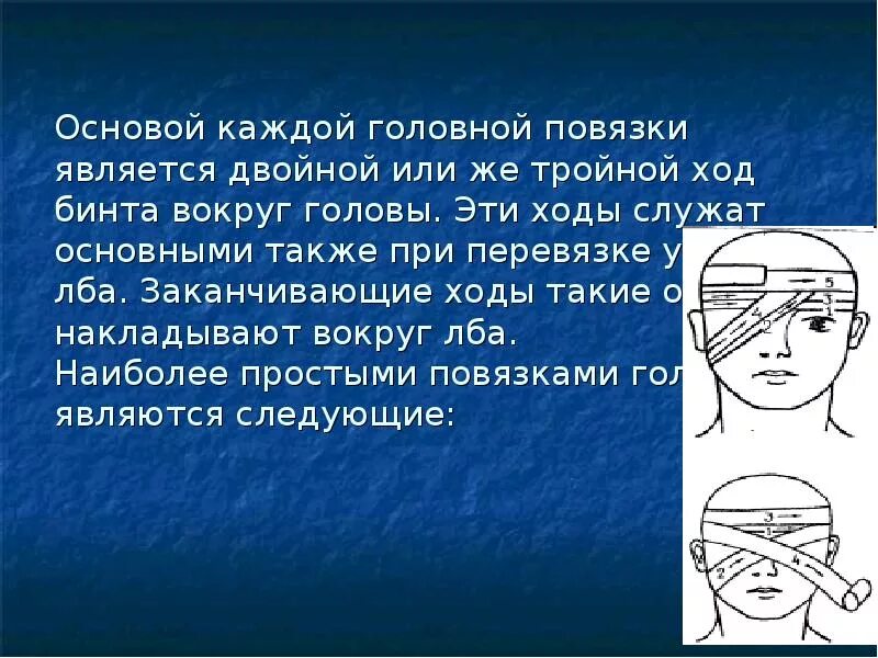 Повязка на голову ОБЖ. Наложение повязки на голову картинка. Перевязка головы ОБЖ. Общее правило наложения повязок.