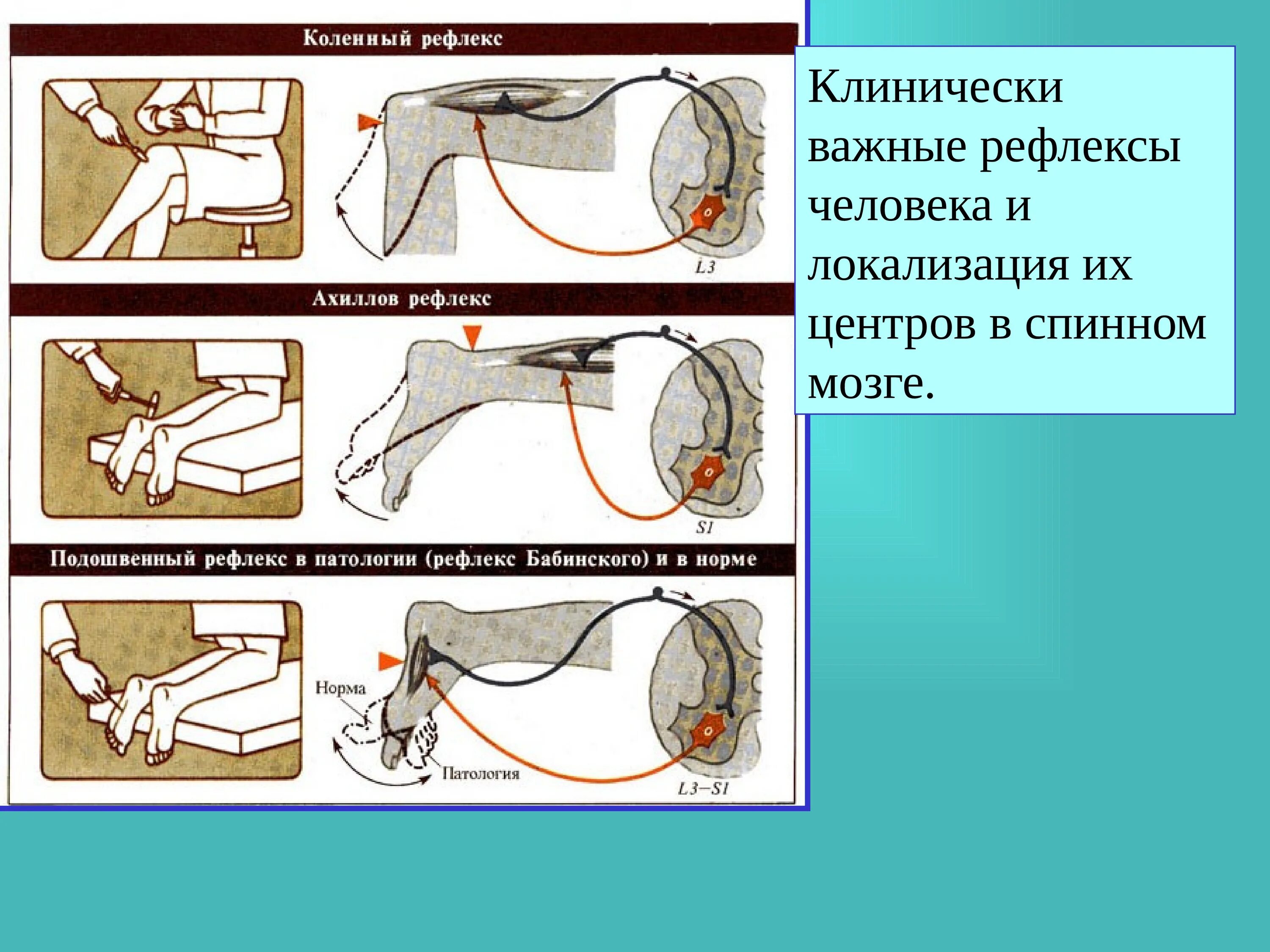 Какие защитные рефлексы. Ахиллов рефлекс рефлекторная. Коленный и Ахиллов рефлексы. Коленный и Ахиллов рефлексы физиология. Схема рефлекторной дуги ахиллова рефлекса.