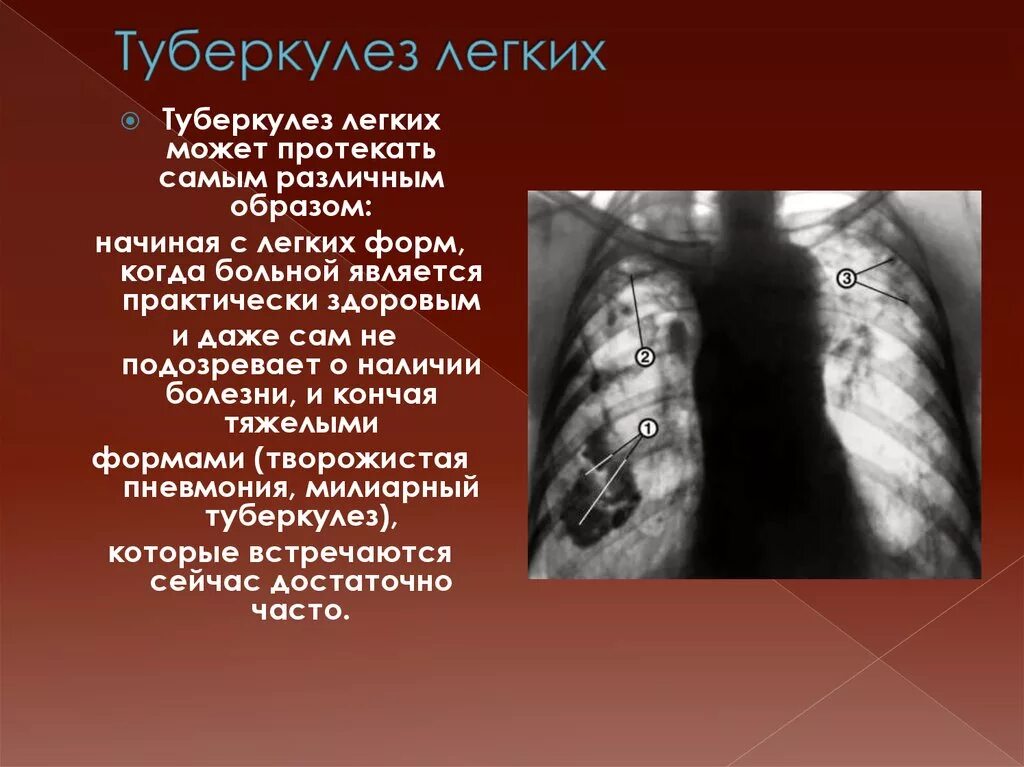 Является одним из самых легких