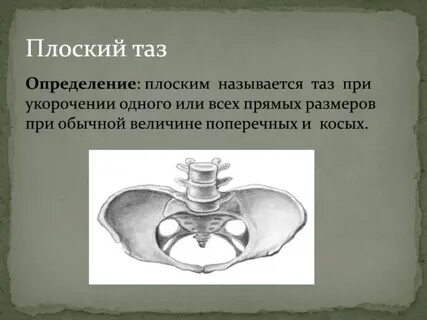 Плоский таз размеры
