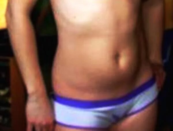 Левое ребро выпирает больше правого. Левое ребро выпирает больше правого. Левое ребро выпирает больше правого. Левое ребро выпирает больше правого. Левое ребро выпирает больше правого.