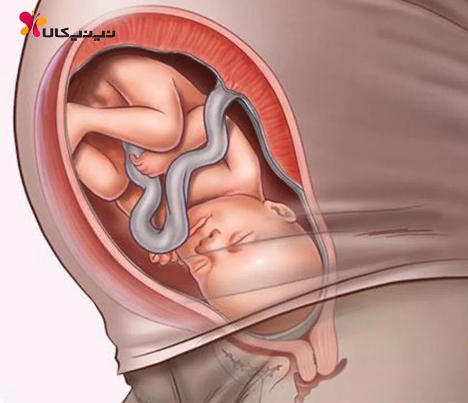 младенец в утробе матери фото. что чувствует ребёнок в утробе. малыш улыбается в утробе. ребенок в утробе чихает. ребенок в утробе чихает.