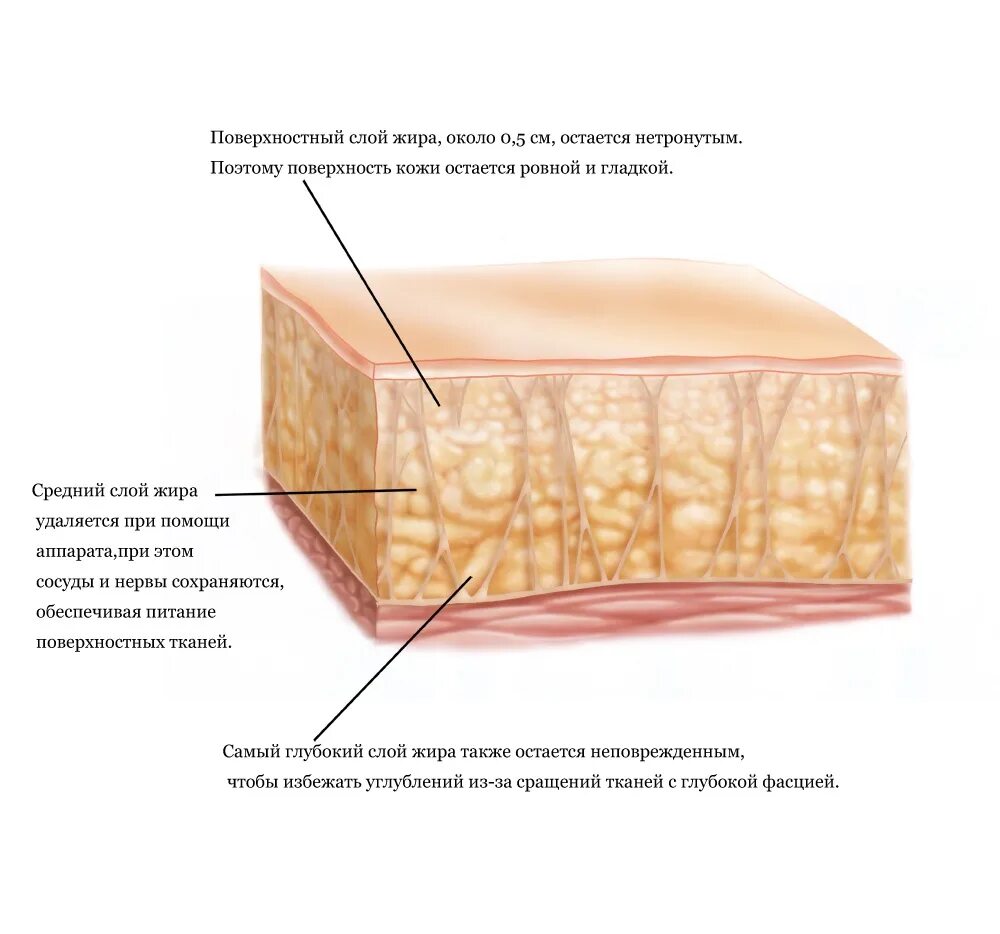 Жировой слой кожи.