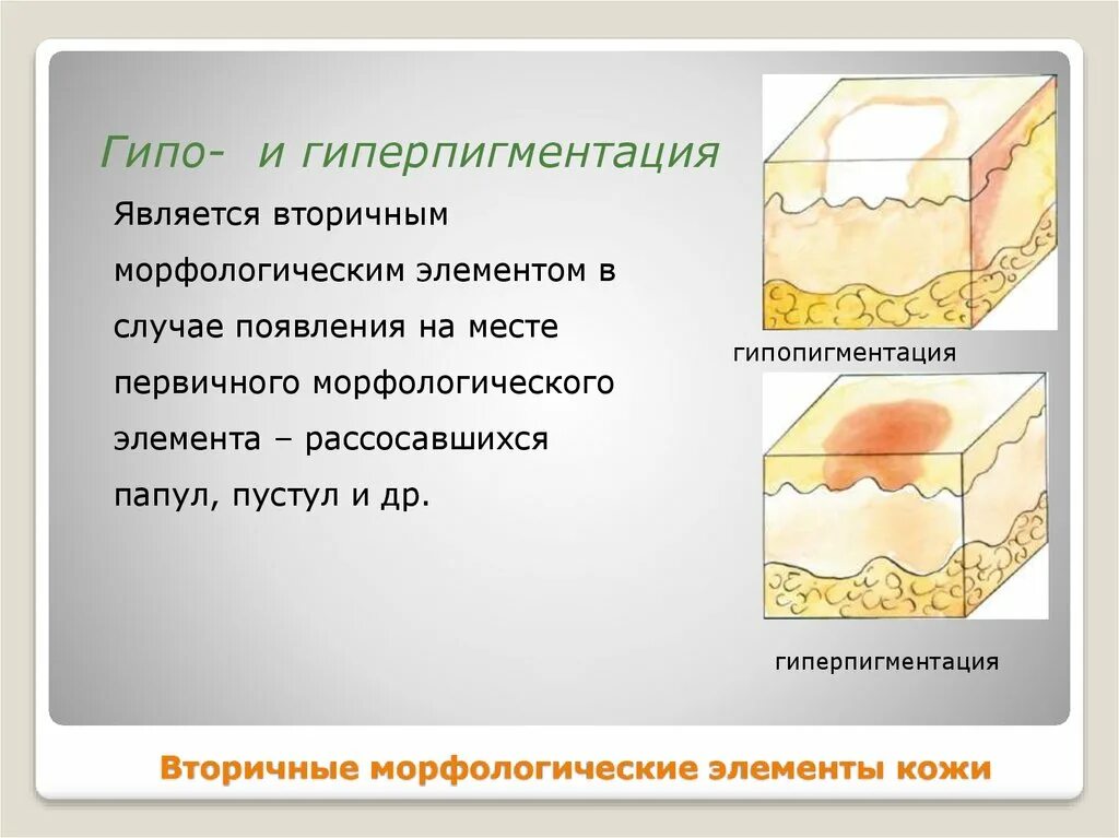 Пятно первичный элемент. Первичные бесполостные морфологические элементы кожи. вторичные морфологические элементы кожи гиперпигментация. первичные элементы сыпи. вторичные морфологические элементы кожи.