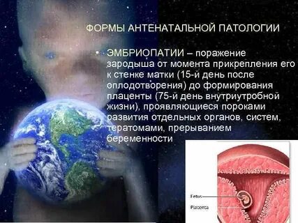 Влияние внешней среды на развитие зародыша человека