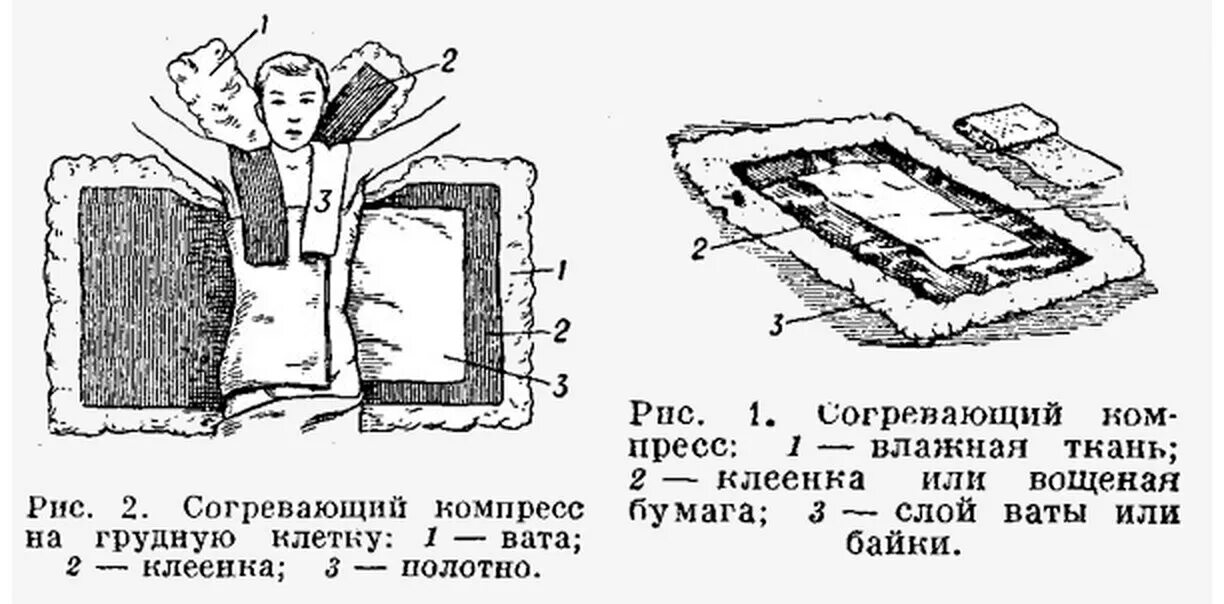 Спиртовой компресс на ухо