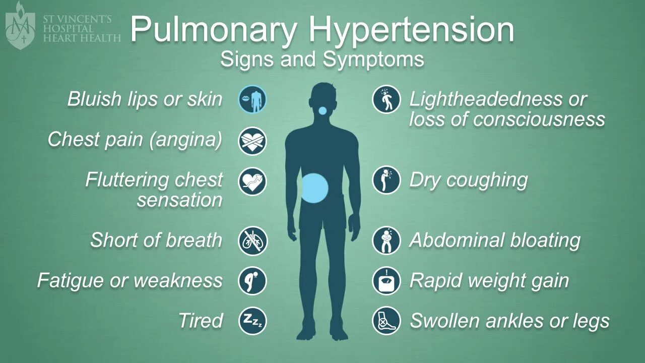 Hypertension Symptoms. Симптомы ХСН У мужчин. Сердечная недостаточность у мужчин после 50