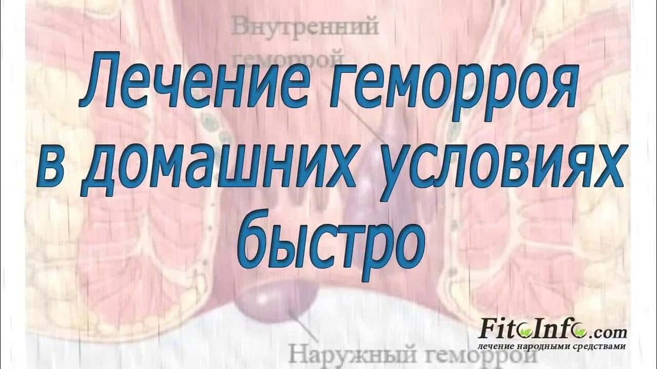 Как быстро убрать геморрой в домашних. Геморрой лечение в домашних условиях. Лечения геморроя домашнее условия. Геморрой народные средства. Лечить геморрой в домашних условиях.