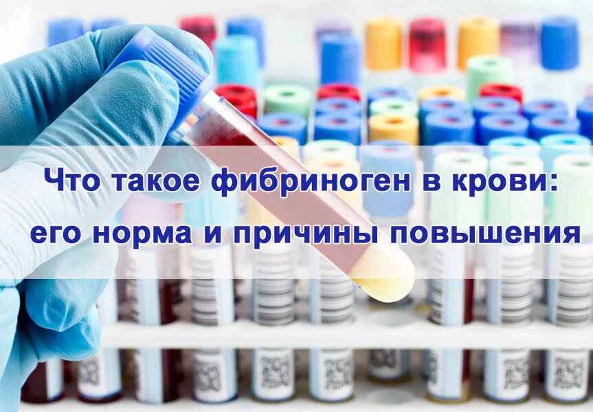 Где содержится фибриноген. Фибриноген в крови. фибриноген пробирка. фибриноген (5*2 мл) (кат. № 32002).