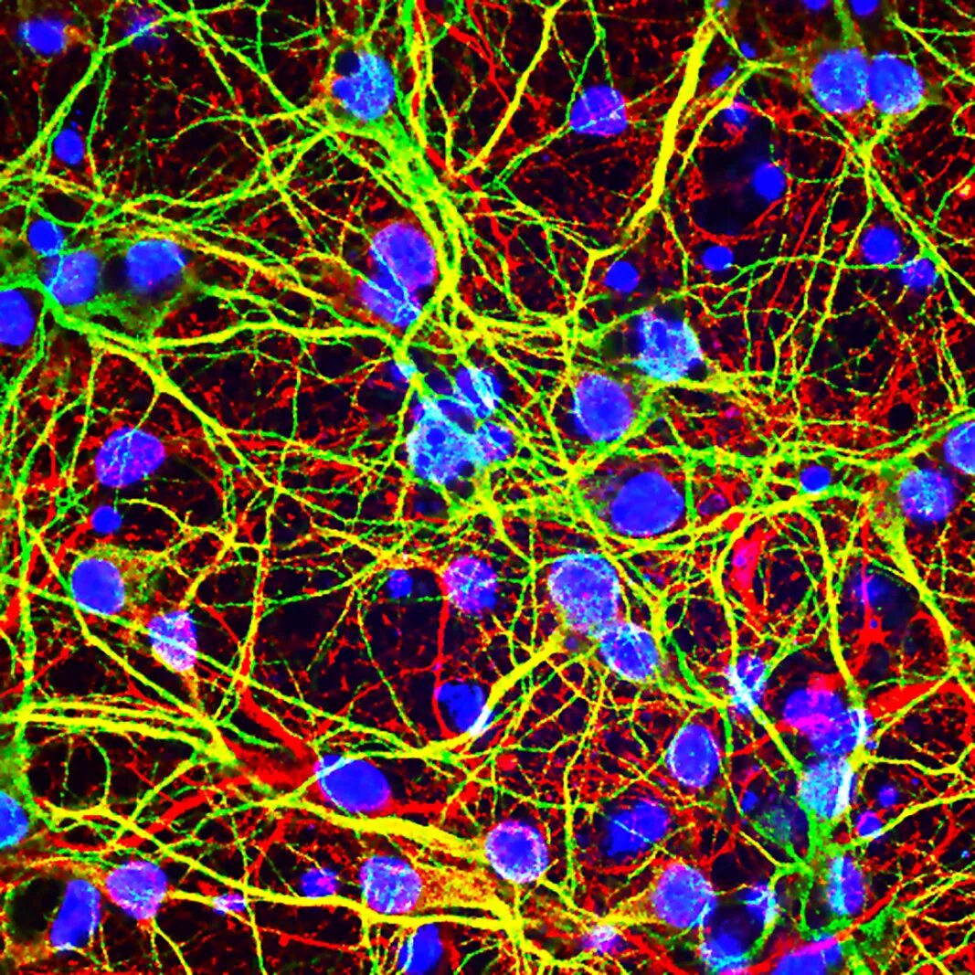 Нейронная клетка. Клетки мозга под микроскопом. Нейроны головного мозга. Нейронные клетки головного мозга.