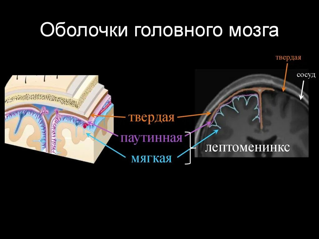 Сосудистая оболочка мозга. Оболочки головного мозга мрт анатомия. Паутинная оболочка головного мозга анатомия. Утолщение твердой мозговой оболочки головного мозга мрт. Твердая и мягкая мозговая оболочка мрт.