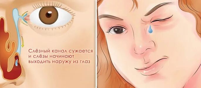 Сужающийся. Канал сужается. Волатильность на графике. Сужающийся канал технический анализ. Канал сужается.