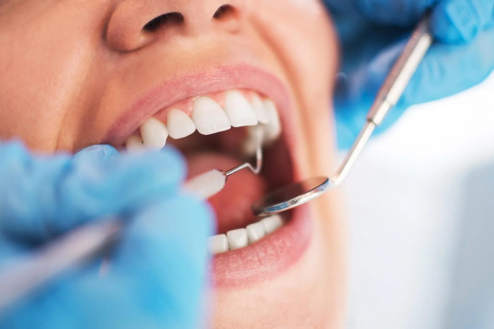 Гигиена рта состояние рта. Осмотр стоматолога. Зубы стоматология. Терапия стоматология.