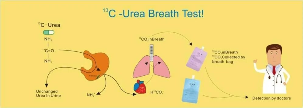 Дыхательный тест с мочевиной. Urea Breath Test. Набор ХЕЛИКАРБ для 13c уреазный дыхательный тест. Carbon urea Breath Tests.