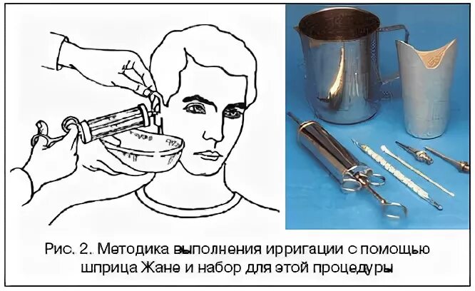 Как промыть пробку шприцем