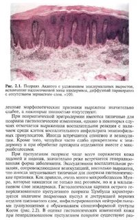 Паракератоз шейки матки