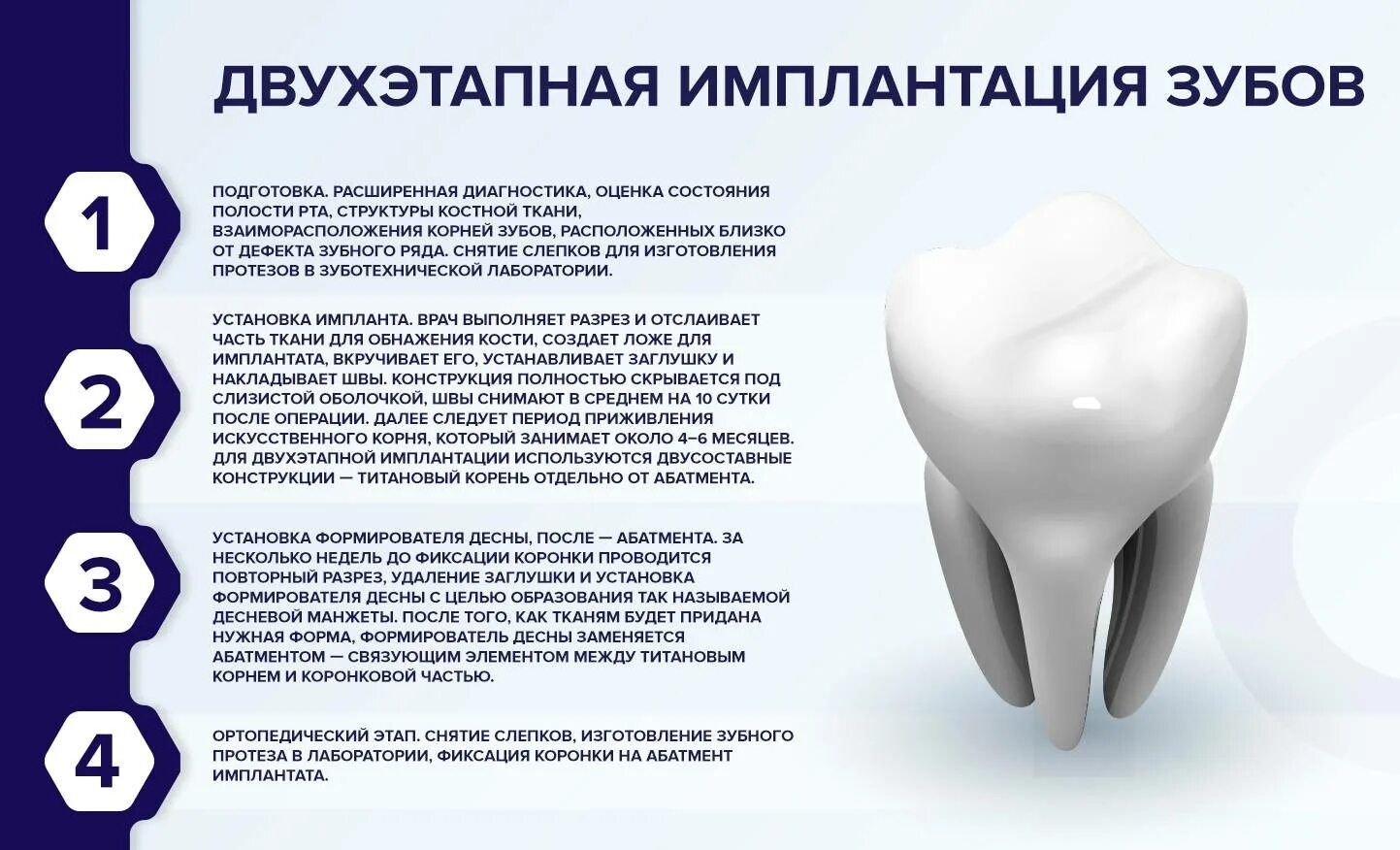 Как происходит установка импланта. Двухэтапный подходы в использовании дентальных имплантатов.. схема установки стоматологических имплантов. этапы установления имплантата зуба.