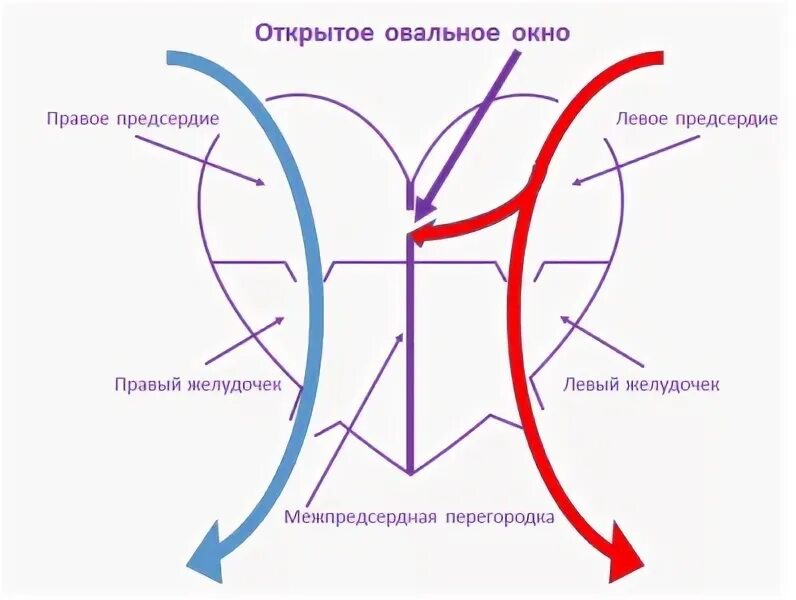 Мкб 10 картинки. Рвота диагноз мкб 10. Открытое овальное окно формулировка диагноза. Открытое овальное окно. Малая аномалия развития сердца.