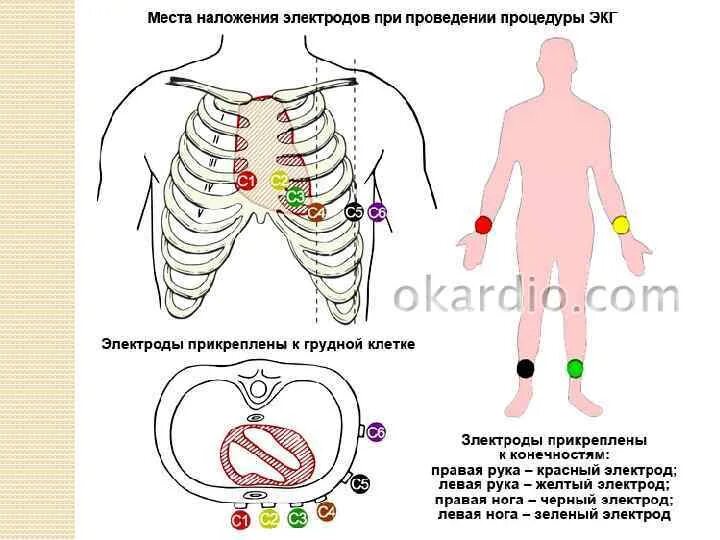 Прохождение ЭКГ в КДЦ 24