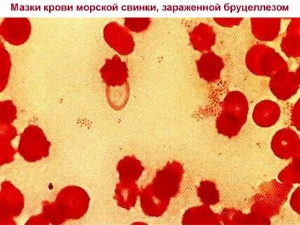 Возбудители молока