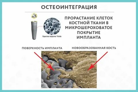 Костной среда