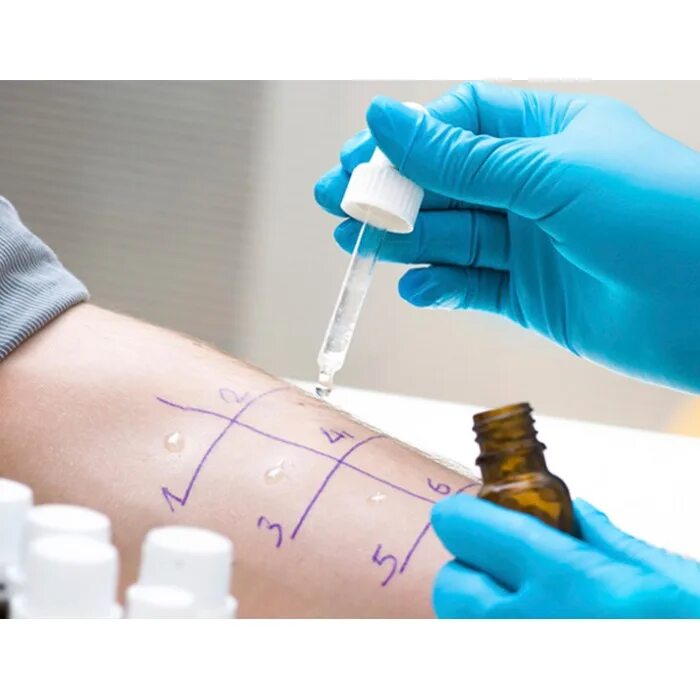 Выявление аллергена. Аллергология и иммунология. Набор для кожных проб. Клиническая иммунология и аллергология фоны.