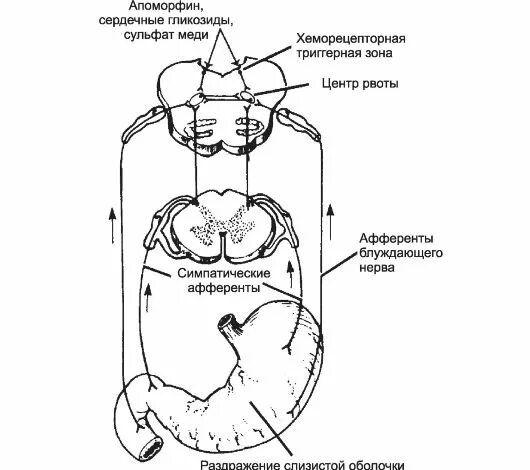 Рвотный рефлекс рвота. Рвотный рефлекс рефлекторная дуга схема. Рефлекторный путь рвотного рефлекса схема. Рефлекторная дуга рвотного рефлекса схема. Рвотный рефлекс механизм.