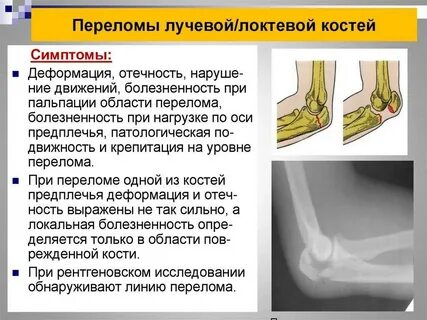 Сколько времени заживает вывих