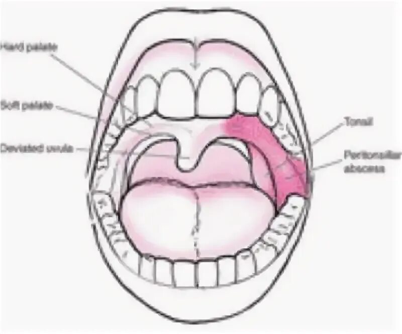 Увула 6 букв. Uvula продольный срез.