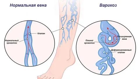 Вен н