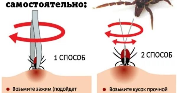 Как вытащить клеща у человека в домашних. Как вытащить клеща самостоятельно у человека. Как достать клеща у человека ниткой. Как правило вытащить клеща. Как правильно вытащить клеща у собаки.