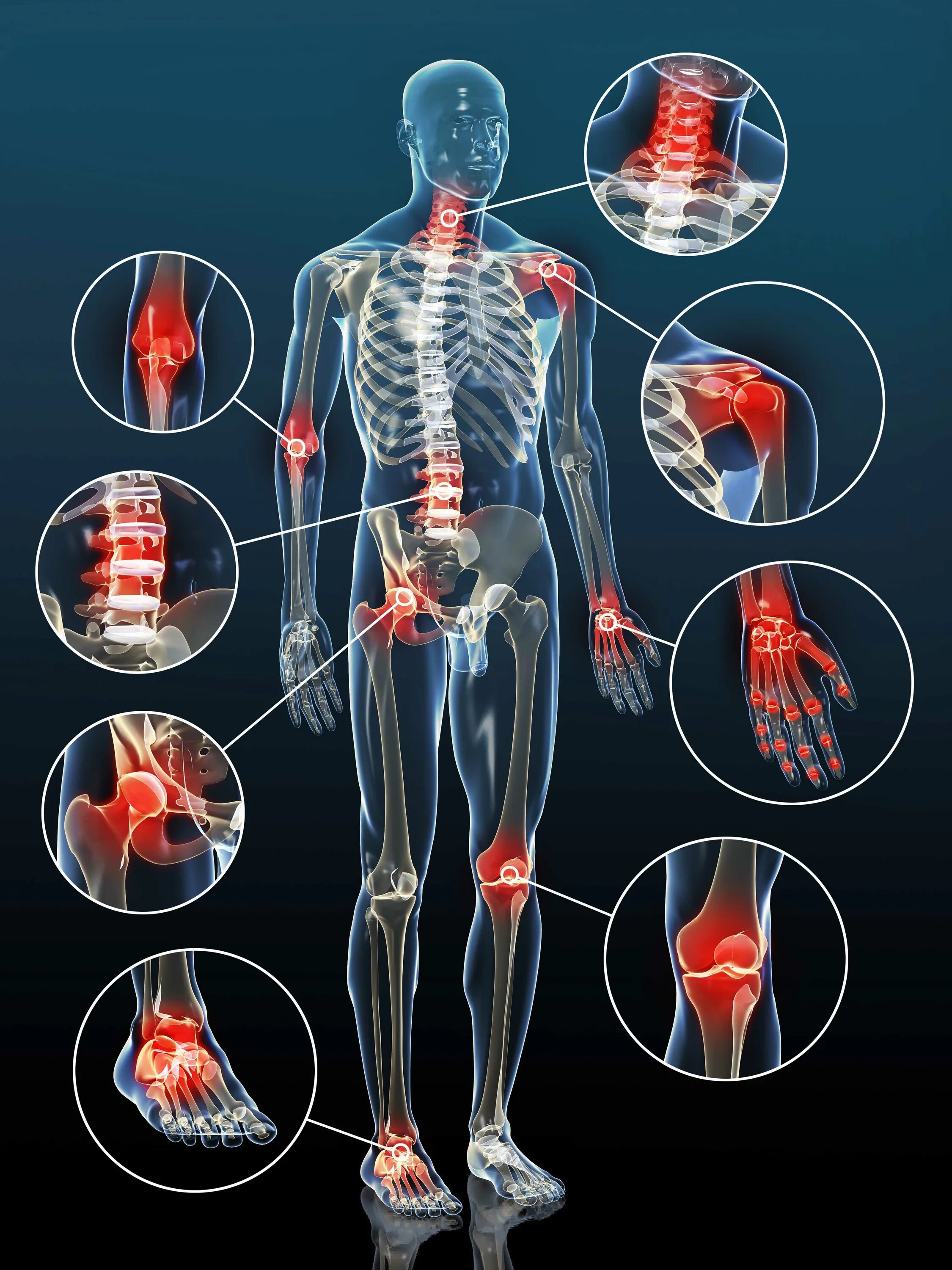 Болезни костно-мышечной системы и соединительной ткани. Болезни костно-мышечной системы (опорно-двигательного аппарата). Костносустовная система. Боль в суставах.