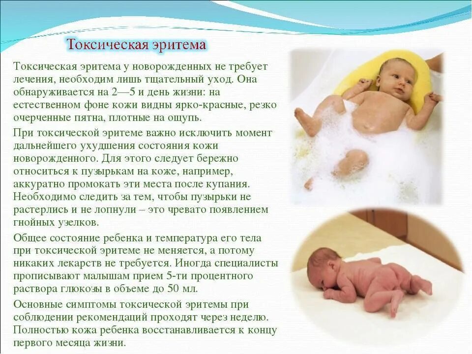 Транзиторная токсическая эритема. Токсическая эритема новорожденных. Неонатальная токсическая эритема. Токсическая эритема у младенцев. Транзиторная эритема кожи.