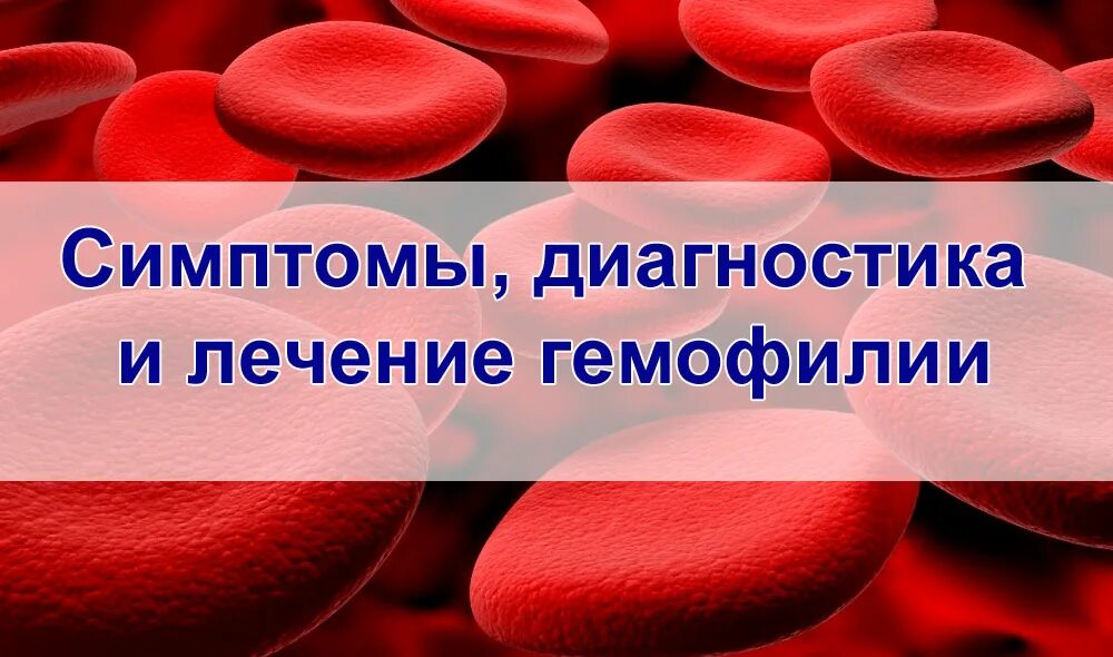 Дети больные гемофилией. Проявления лимфосаркомы. Лимфосаркома клинические проявления.