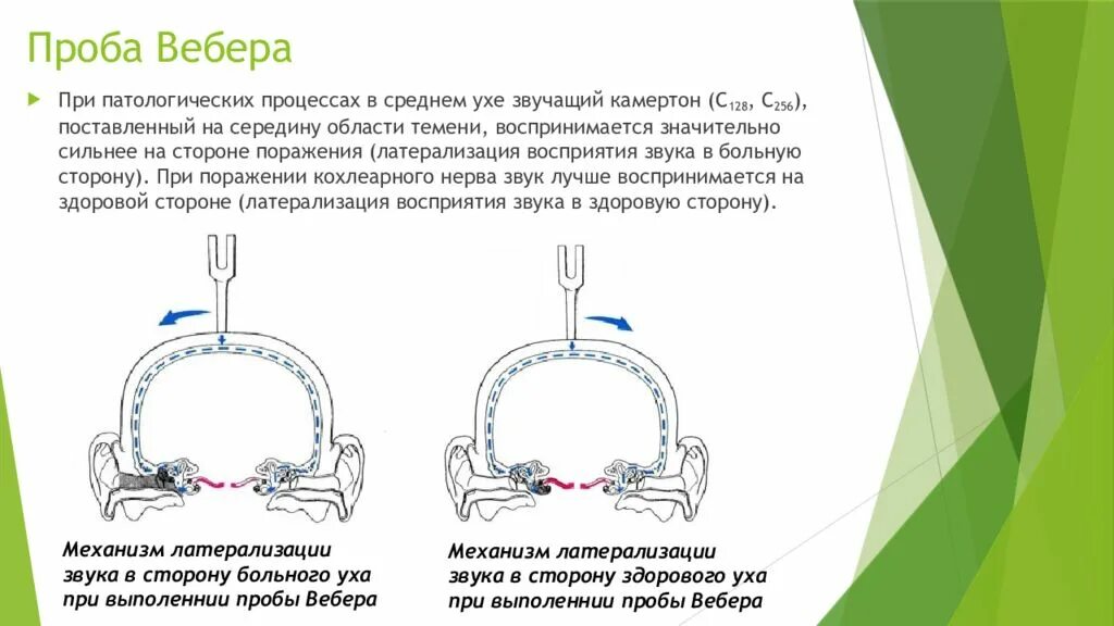 Исследование камертонами слуха опыт Ринне. Проба Вебера. Проба Ринне и Вебера. Проба Вебера Ринне Швабаха.