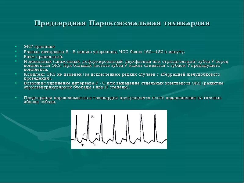 Чсс 140