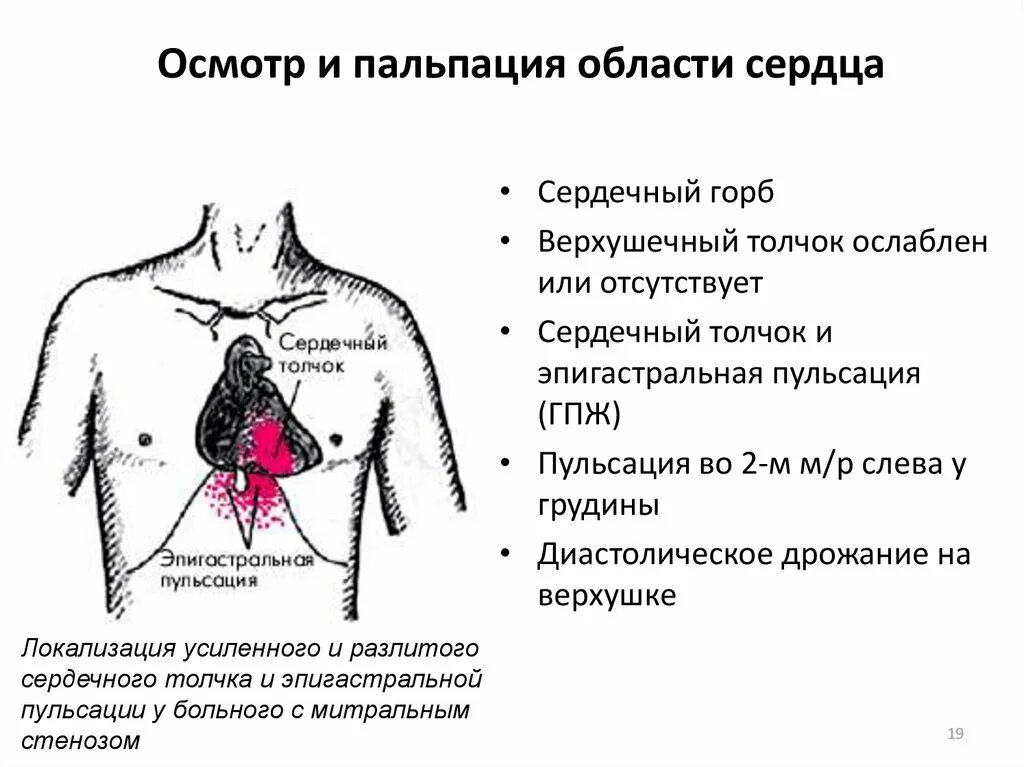 Сердечный толчок пульсация. Пальпация области сердца пропедевтика. осмотр области сердца пропедевтика. верхушечный толчок сердца локализация. пальпация области сердца верхушечный толчок.