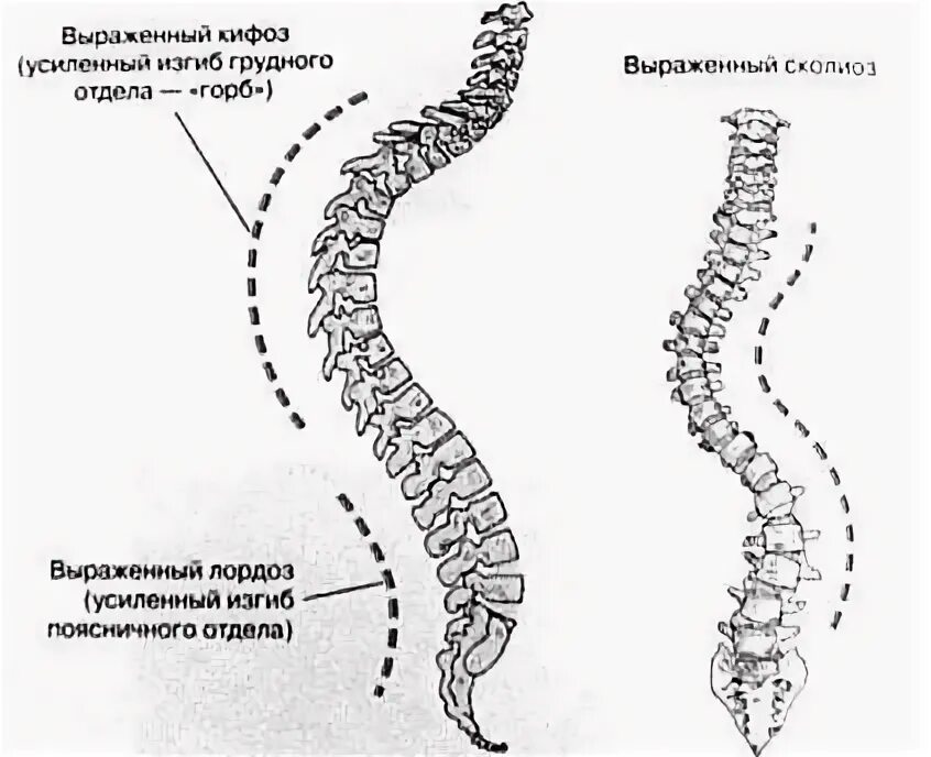 Позвоночник рис 28. Изгибы позвоночника в сагиттальной плоскости. Изгиб позвоночного столба кпереди характерен для. Изгиб позвоночника у собаки. Изгибы позвоночника млекопитающих