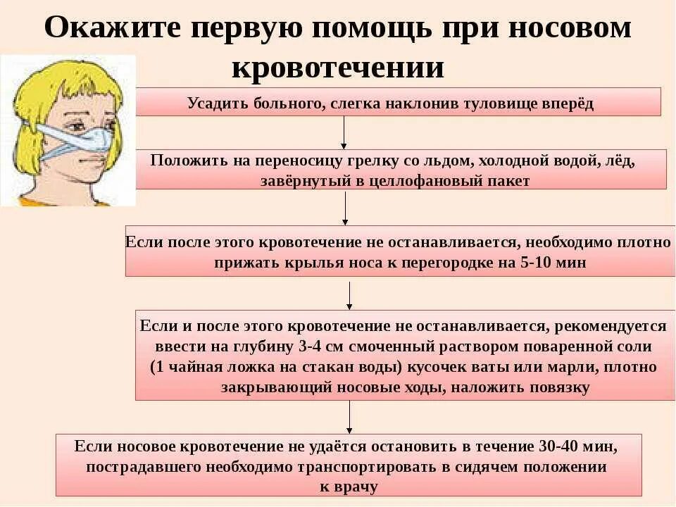 Какое положение при носовом кровотечении. Алгоритм оказания ПМП при носовом кровотечении. Алгоритм ПМП при кровотечениях из носа. Алгоритм оказание ПП при носовом кровотечении. Первая помощь при носовом кровотечении у детей алгоритм действий.