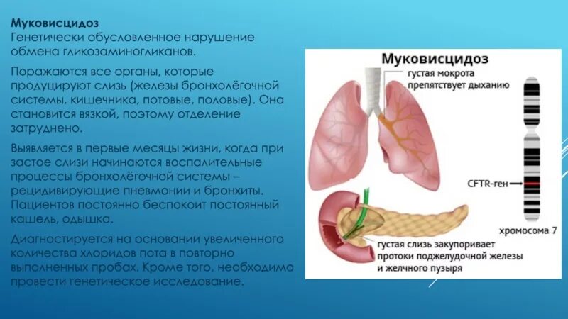 Муковисцидоз мокрота