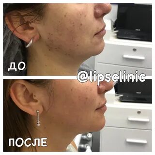 Со2 отзывы