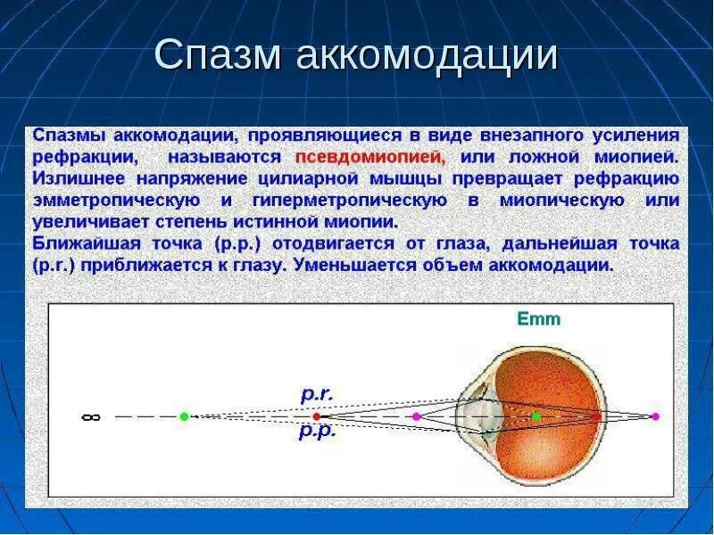 В аккомодации участвуют. Мышцы аккомодации глаза. Нарушение аккомодации ложная близорукость. Спазм аккомодации ложная близорукость. Рефракция глаза при спазме аккомодации при исходной эмметропии.